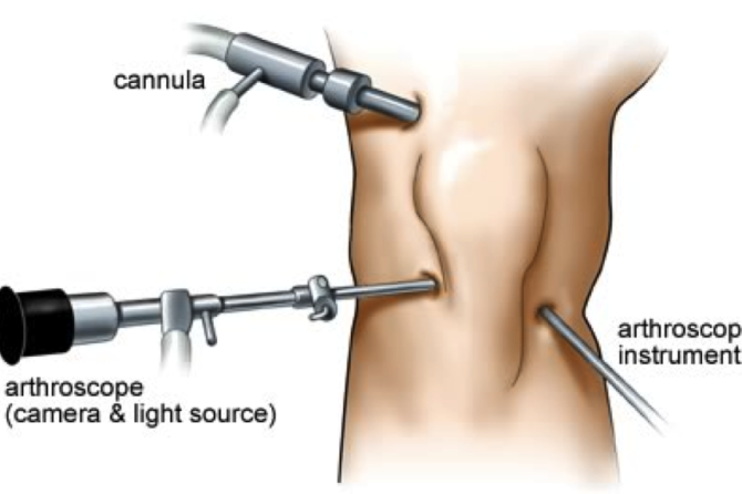Arthroscopic Menlo Park Terrace NJ